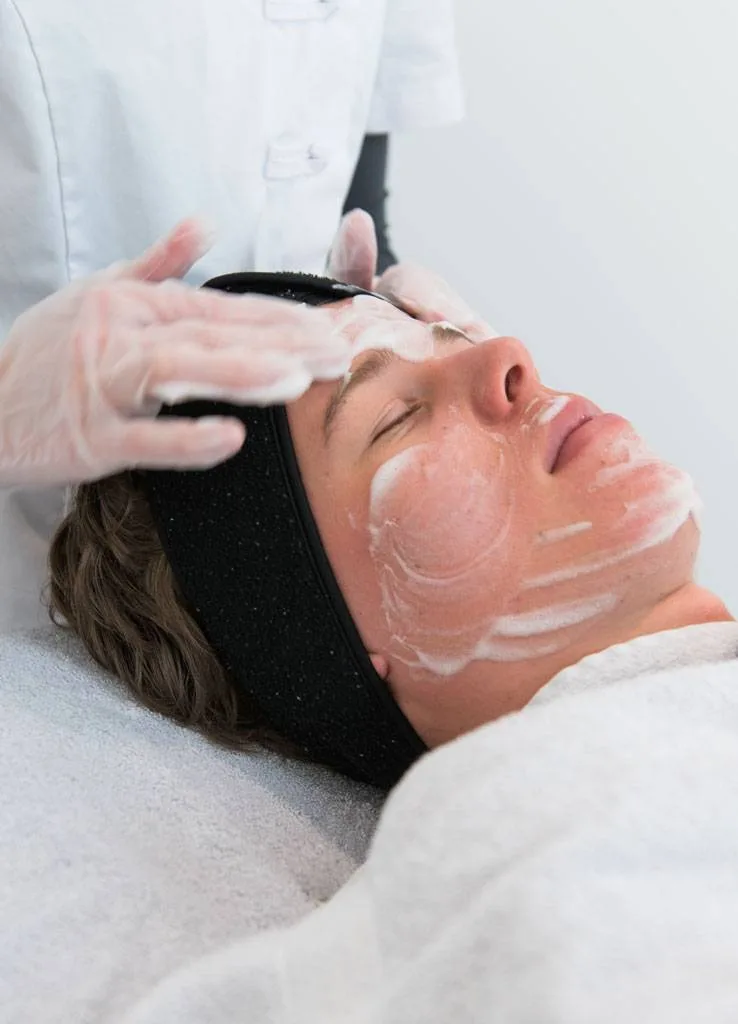 Acnetherapie bij Apotheek&Beauty Monster
