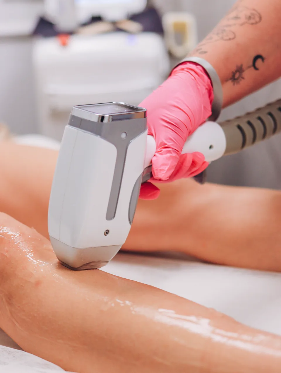 Laserontharing lichaam bij Apotheek&Beauty Monster